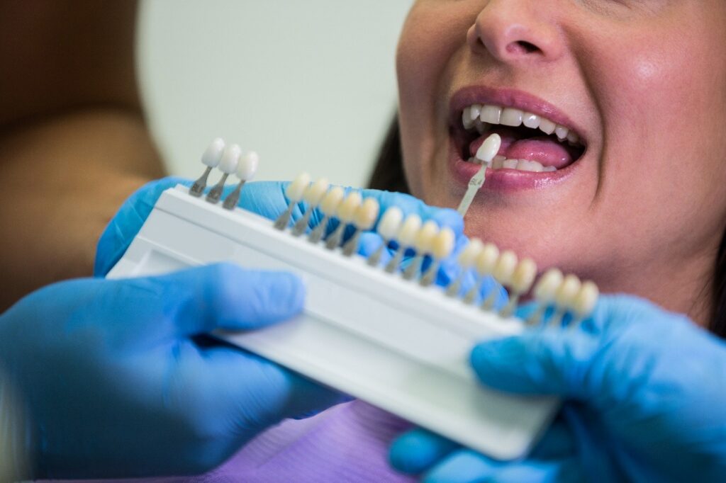dental implants in Marietta