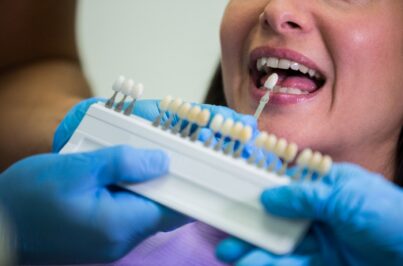 dental implants in Marietta